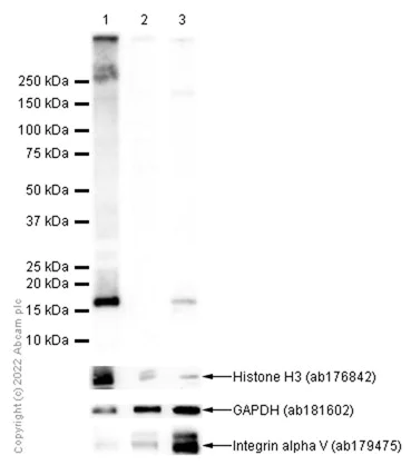 Western blot - Anti-HMGA1 antibody [EPR7839] (AB129153)