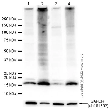 Western blot - Anti-HMGA1 antibody [EPR7839] (AB129153)