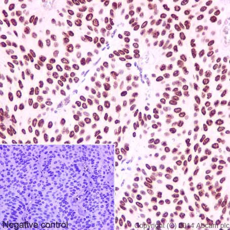 Immunohistochemistry (Formalin/PFA-fixed paraffin-embedded sections) - Anti-HMGA1 antibody [EPR7839] - BSA and Azide free (AB226112)