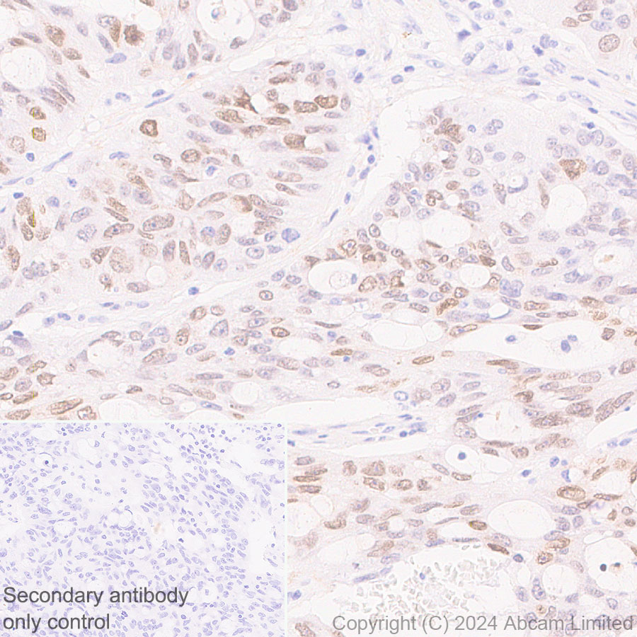 Immunohistochemistry (Formalin/PFA-fixed paraffin-embedded sections) - Anti-HMGA1 antibody [RM1061] (ab315350), expandable thumbnail