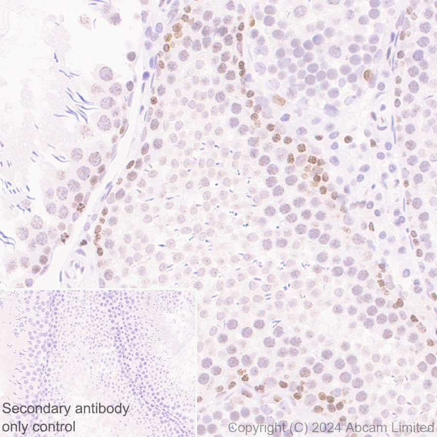 Immunohistochemistry (Formalin/PFA-fixed paraffin-embedded sections) - Anti-HMGA1 antibody [RM1061] (ab315350), expandable thumbnail
