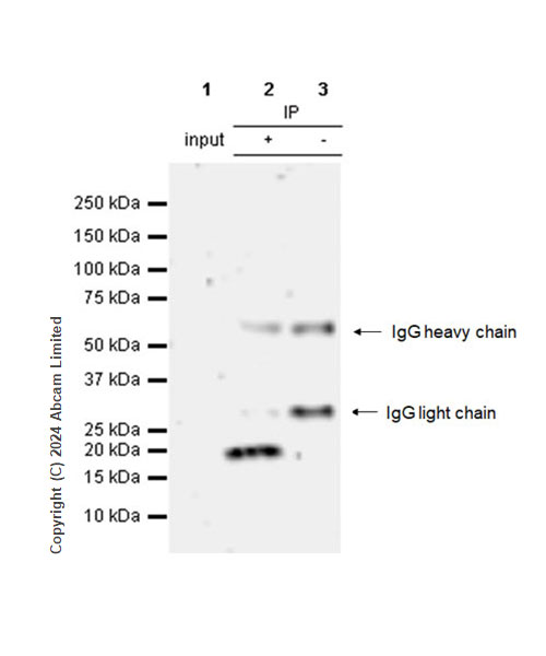 Immunoprecipitation - Anti-HMGA1 antibody [RM1061] (ab315350), expandable thumbnail