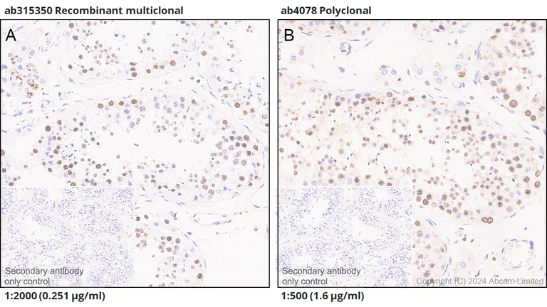 Immunohistochemistry (Formalin/PFA-fixed paraffin-embedded sections) - Anti-HMGA1 antibody [RM1061] - BSA and Azide free (AB315351)