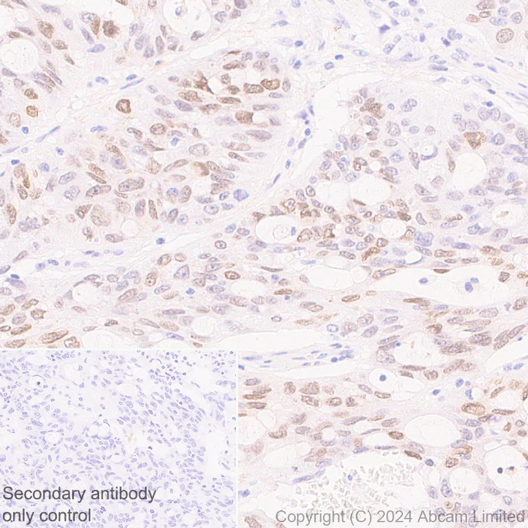 Immunohistochemistry (Formalin/PFA-fixed paraffin-embedded sections) - Anti-HMGA1 antibody [RM1061] - BSA and Azide free (AB315351)