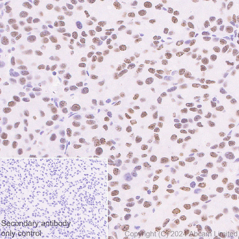 Immunohistochemistry (Formalin/PFA-fixed paraffin-embedded sections) - Anti-HMGA1 antibody [RM1061] - BSA and Azide free (AB315351)