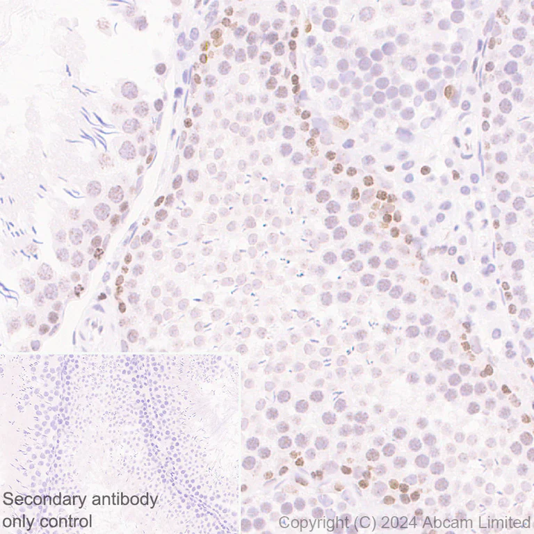 Immunohistochemistry (Formalin/PFA-fixed paraffin-embedded sections) - Anti-HMGA1 antibody [RM1061] - BSA and Azide free (AB315351)