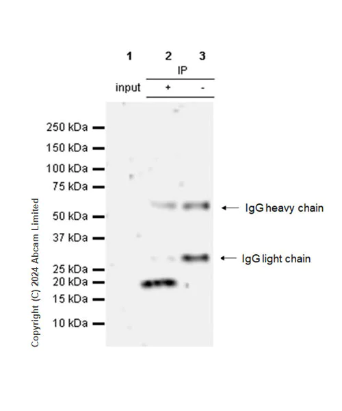 Immunoprecipitation - Anti-HMGA1 antibody [RM1061] - BSA and Azide free (AB315351)