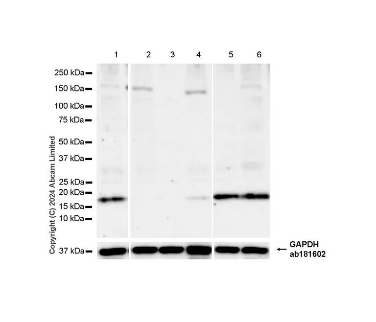Western blot - Anti-HMGA1 antibody [RM1061] - BSA and Azide free (AB315351)