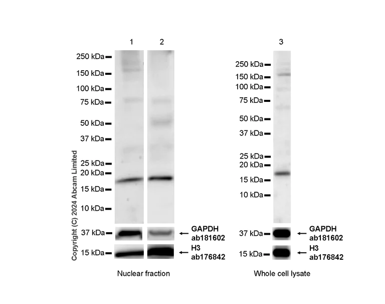Western blot - Anti-HMGA1 antibody [RM1061] - BSA and Azide free (AB315351)