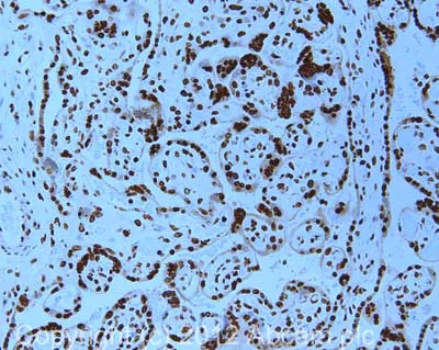 Immunohistochemistry (Formalin/PFA-fixed paraffin-embedded sections) - Anti-HMGA1a / HMGA1b antibody (AB4078)