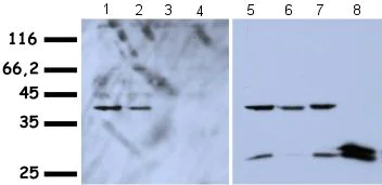 Western blot - Anti-HMGA1a / HMGA1b antibody (AB4078)