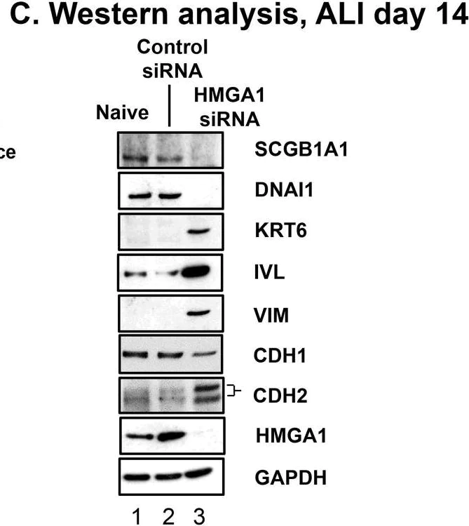 Western blot - Anti-HMGA1a / HMGA1b antibody (AB4078)