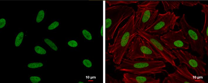 Immunocytochemistry/ Immunofluorescence - Anti-HMGA2 antibody (AB97276), expandable thumbnail