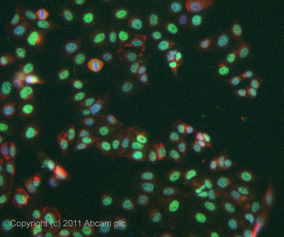 Immunocytochemistry/ Immunofluorescence - Anti-HMGA2 antibody (ab97276), expandable thumbnail