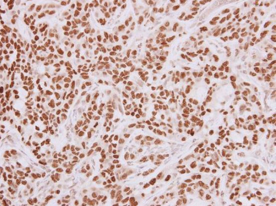 Immunohistochemistry (Formalin/PFA-fixed paraffin-embedded sections) - Anti-HMGA2 antibody (ab97276), expandable thumbnail