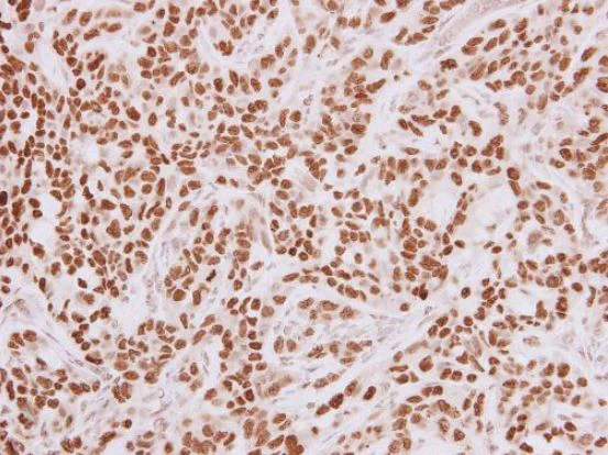 Immunohistochemistry (Formalin/PFA-fixed paraffin-embedded sections) - Anti-HMGA2 antibody (AB97276)