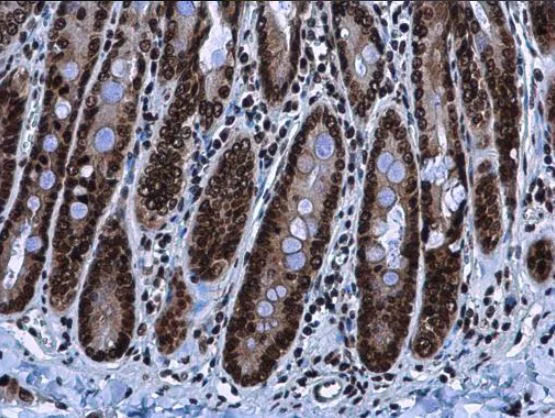 Immunohistochemistry (Formalin/PFA-fixed paraffin-embedded sections) - Anti-HMGA2 antibody (AB97276)