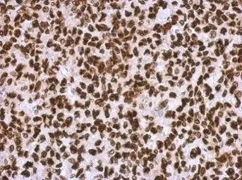 Immunohistochemistry (Formalin/PFA-fixed paraffin-embedded sections) - Anti-HMGA2 antibody (AB97276)