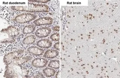 Immunohistochemistry (Formalin/PFA-fixed paraffin-embedded sections) - Anti-HMGA2 antibody (AB97276)