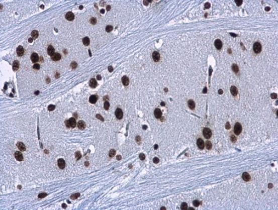 Immunohistochemistry (Formalin/PFA-fixed paraffin-embedded sections) - Anti-HMGA2 antibody (ab97276), expandable thumbnail