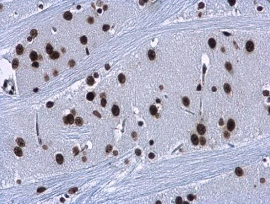Immunohistochemistry (Formalin/PFA-fixed paraffin-embedded sections) - Anti-HMGA2 antibody (AB97276)