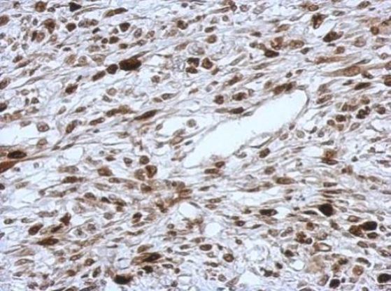 Immunohistochemistry (Formalin/PFA-fixed paraffin-embedded sections) - Anti-HMGA2 antibody (AB97276), expandable thumbnail