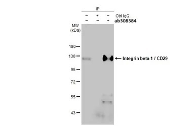 Immunoprecipitation - Anti-HMGA2 antibody (ab97276), expandable thumbnail