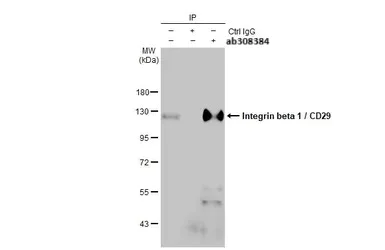 Immunoprecipitation - Anti-HMGA2 antibody (AB97276)
