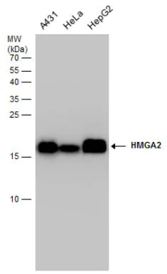 Western blot - Anti-HMGA2 antibody (AB97276)