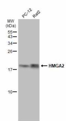 Western blot - Anti-HMGA2 antibody (ab97276), expandable thumbnail