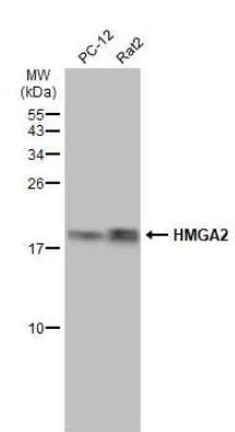 Western blot - Anti-HMGA2 antibody (AB97276)