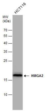 Western blot - Anti-HMGA2 antibody (AB97276)