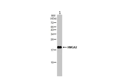 Western blot - Anti-HMGA2 antibody (AB97276)