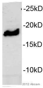 Western blot - Anti-HMGA2 antibody (AB97276)