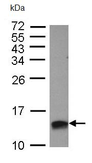Western blot - Anti-HMGA2 antibody (ab97276), expandable thumbnail