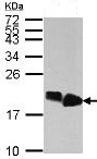 Western blot - Anti-HMGA2 antibody (ab97276), expandable thumbnail