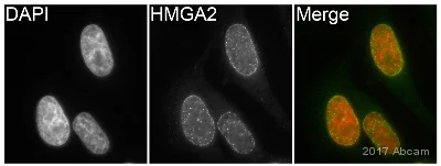 Immunocytochemistry/ Immunofluorescence - Anti-HMGA2 antibody [EPR18114] (AB207301)