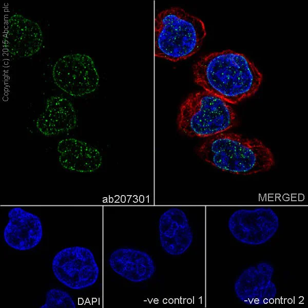 Immunocytochemistry/ Immunofluorescence - Anti-HMGA2 antibody [EPR18114] - BSA and Azide free (AB251468)