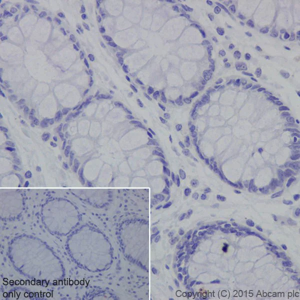Immunohistochemistry (Formalin/PFA-fixed paraffin-embedded sections) - Anti-HMGA2 antibody [EPR18114] - BSA and Azide free (AB251468)