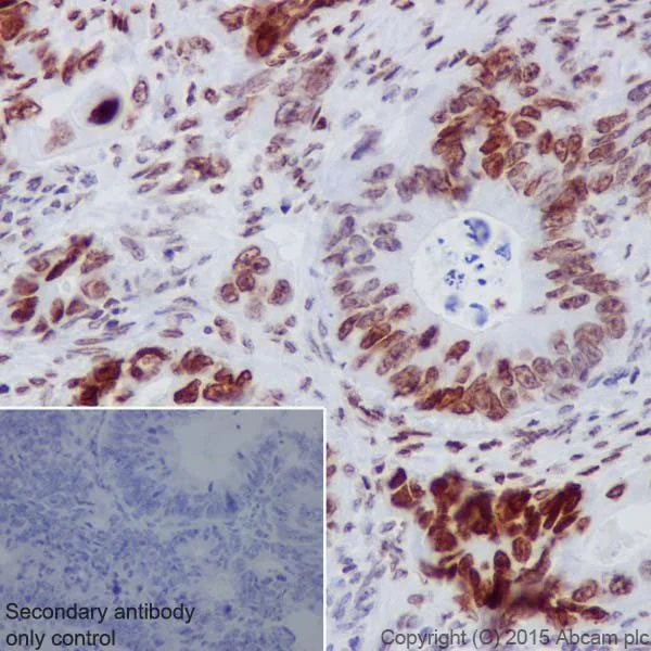 Immunohistochemistry (Formalin/PFA-fixed paraffin-embedded sections) - Anti-HMGA2 antibody [EPR18114] - BSA and Azide free (AB251468)