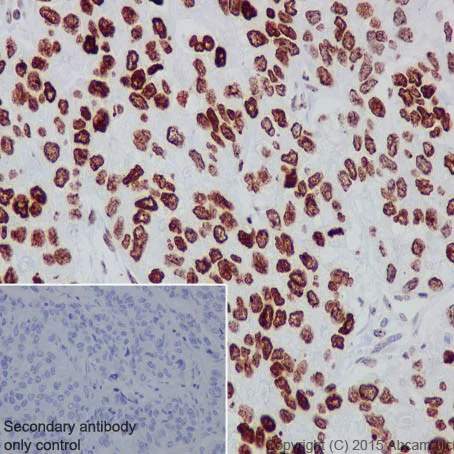Immunohistochemistry (Formalin/PFA-fixed paraffin-embedded sections) - Anti-HMGA2 antibody [EPR18114] - BSA and Azide free (AB251468)