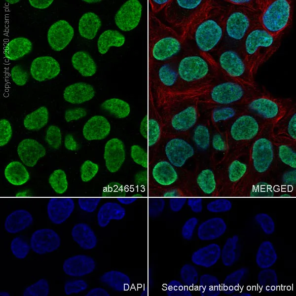 Immunocytochemistry/ Immunofluorescence - Anti-HMGA2 antibody [EPR23215-46] - BSA and Azide free (AB273503)