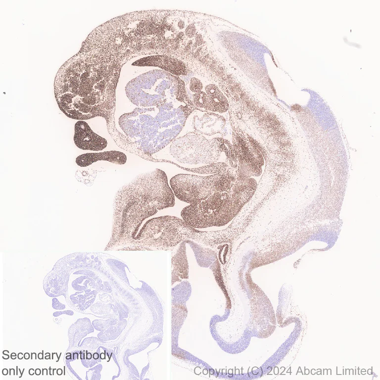 Immunohistochemistry (Formalin/PFA-fixed paraffin-embedded sections) - Anti-HMGA2 antibody [EPR29217-93] - BSA and Azide free (AB319058)