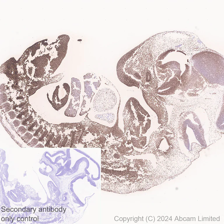 Immunohistochemistry (Formalin/PFA-fixed paraffin-embedded sections) - Anti-HMGA2 antibody [EPR29217-93] - BSA and Azide free (AB319058)