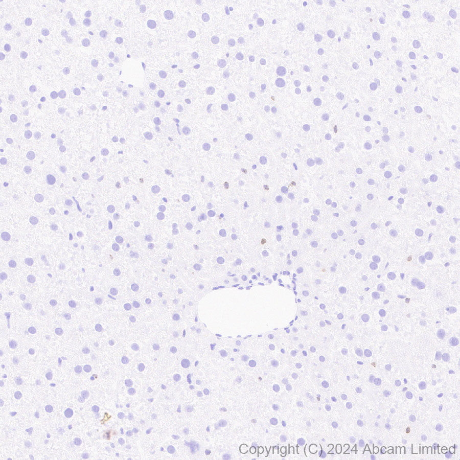 Immunohistochemistry (Formalin/PFA-fixed paraffin-embedded sections) - Anti-HMGA2 antibody [EPR29217-93] - BSA and Azide free (AB319058), expandable thumbnail