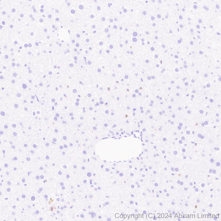 Immunohistochemistry (Formalin/PFA-fixed paraffin-embedded sections) - Anti-HMGA2 antibody [EPR29217-93] - BSA and Azide free (AB319058)