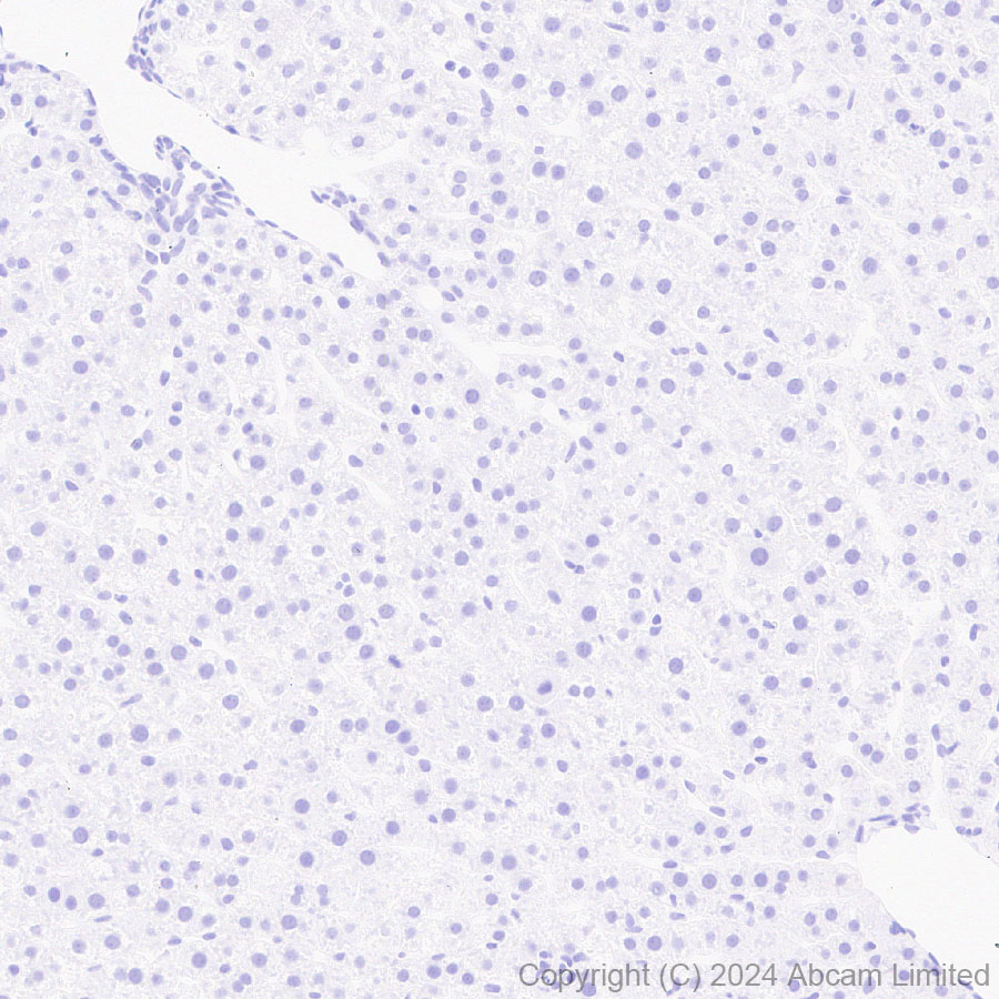 Immunohistochemistry (Formalin/PFA-fixed paraffin-embedded sections) - Anti-HMGA2 antibody [EPR29217-93] - BSA and Azide free (ab319058), expandable thumbnail