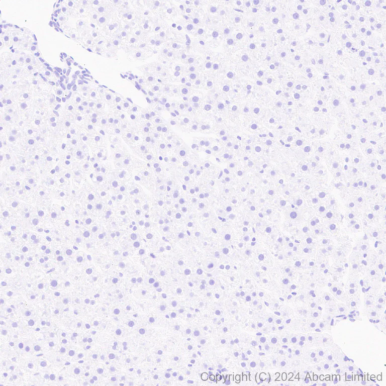 Immunohistochemistry (Formalin/PFA-fixed paraffin-embedded sections) - Anti-HMGA2 antibody [EPR29217-93] - BSA and Azide free (AB319058)