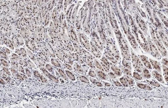 Immunohistochemistry (Formalin/PFA-fixed paraffin-embedded sections) - Anti-HMGA2 antibody [HL1936] (AB308208), expandable thumbnail