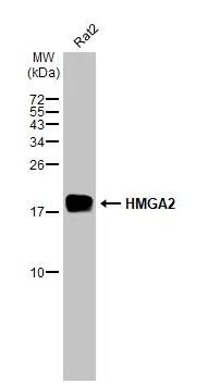 Western blot - Anti-HMGA2 antibody [HL1936] (AB308208), expandable thumbnail